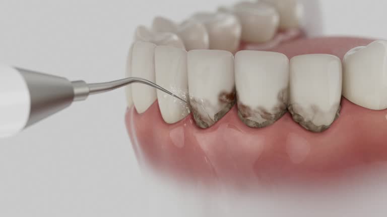 Trusted Dental Implants service in Almont, MI - Dentist Open Now